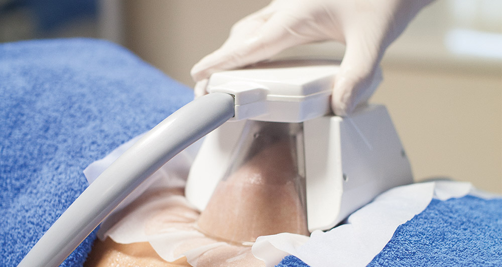 Multiple Areas in One Session HIFU and Fat Freezing Eastleigh 