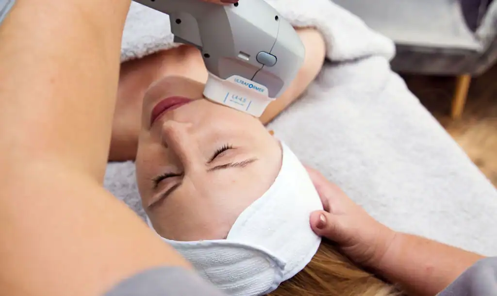 Discover the Perfect Duo: RF Microneedling and HIFU 1 Image of Morpheus8 And HIFU Eastleigh combined treatment